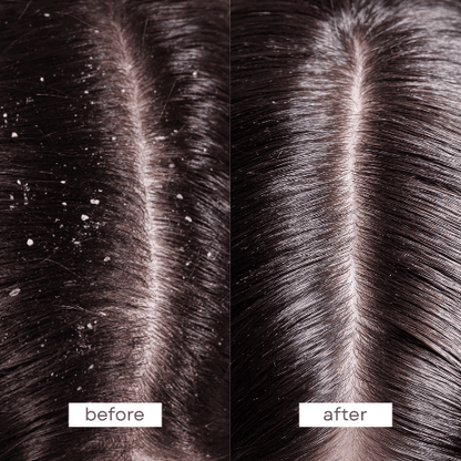 Scalp Therapy Conditioner